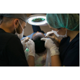 clínica que faz implante capilar frontal Ulysses Guimarães