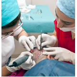 clínica que faz implante capilar para homens Curitibanos