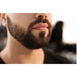 implante de barba rala Zortéa