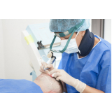 procedimento implante capilar Capivari